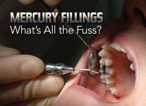 Mecury Fillings