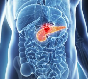 pancreatic_cancer_turmeric
