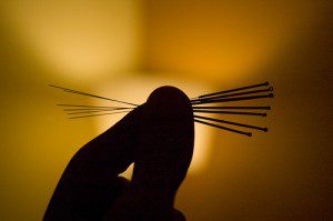 Acupuncture Needles
