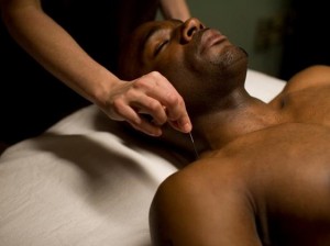 acupuncture