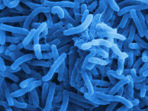 cholera bacteria