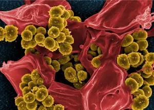 dirty hospitals, deadly consequences