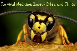 Insect-Bites-and-Stings