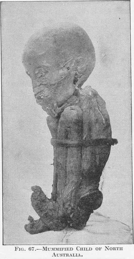 Mummified child - north Australia