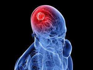 brain toxins