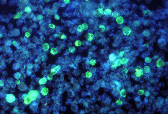 Has This Intuitive Healer Solved the Mystery Behind Chronic Illness - The Answer May Surprise You - Epstein Barr Virus