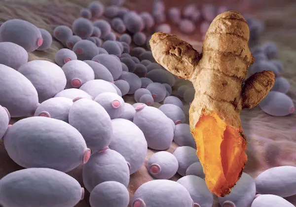 Yeast is a Cause of Cancer and Turmeric Can Kill Both