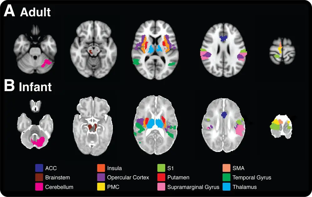 Infants Deeply Traumatized By Common Medical Procedures, New Study Suggests - Brain Pain Comparison