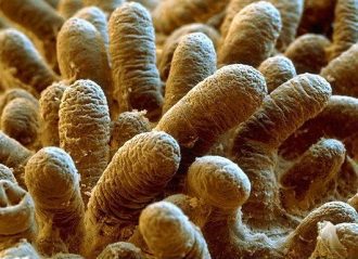 why-a-healthy-gut-is-essential-to-your-wellbeing-and-how-to-restore-it-figure-2-villi-small-intestine