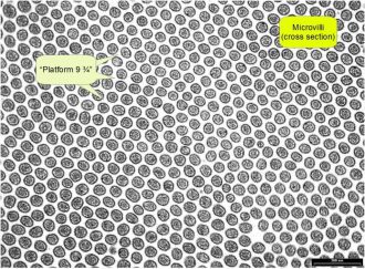 why-a-healthy-gut-is-essential-to-your-wellbeing-and-how-to-restore-it-figure-8-microvilli-field-in-cross-section