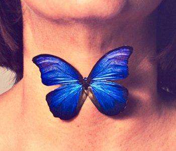 Hypothyroidism or Hashimotos